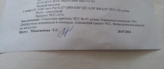 Микроинфаркт, расшифровка заключения по ЭКГ