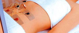 Миома матки и физиопроцедура амплипульс