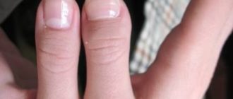 На одной руке пальцы короче, чем на другой