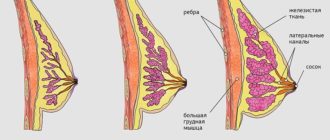 Набухла одна грудь
