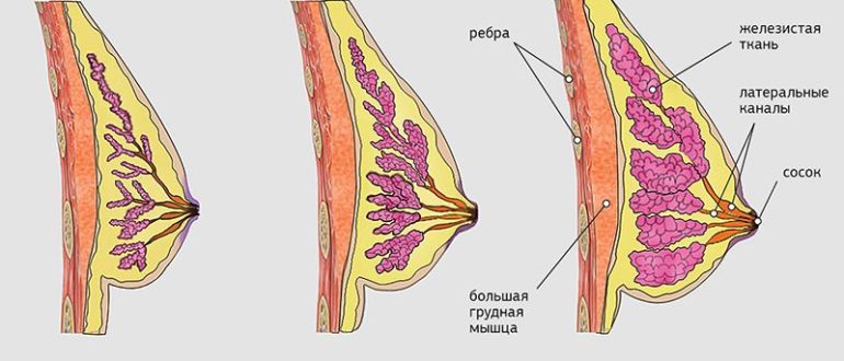 Набухла одна грудь