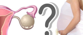 Можно ли забеременеть при наличии кист на обоих яичниках?