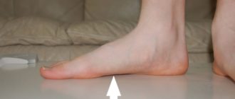 Дискомфорт с внутренней стороны стопы, мешающий нормально ходить