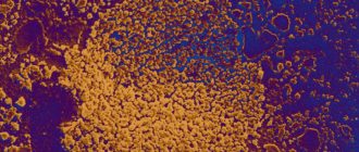 ЭКО и mycoplasma hominis