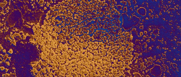 ЭКО и mycoplasma hominis