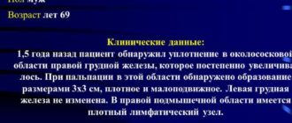 Диагноз: рак правой молочной железы