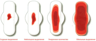 Месячные СТАЛИ ИДТИ МЕНЬШЕ