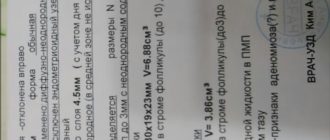 Узи на 25 день цикла