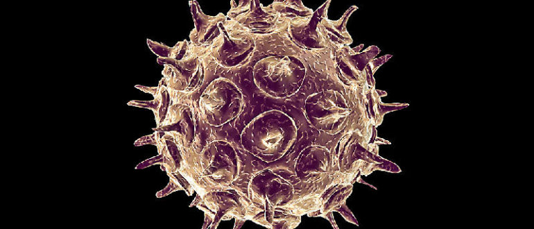 Varicella zoster virus g