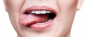 Мыльный привкус во рту