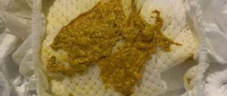 Частый стул при смене смеси