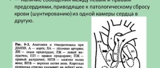 ВПС, ДМПП - 3мм.