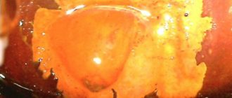 Эктопия, абэ, мозаика