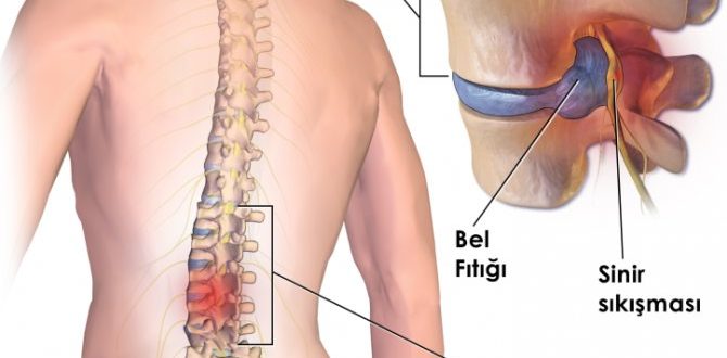 Дискоз поясничного отдела позвоночника, ноет поясница, помогите разобраться