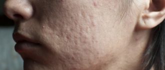 На щеке неровная поверхность