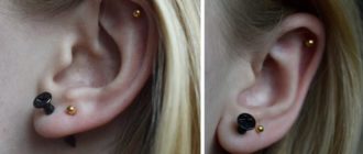 Долго заживают ушки после прокола