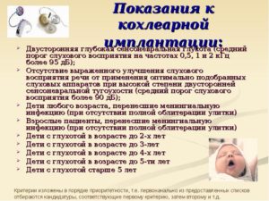 Двусторонняя сенсоневральная тугоухость