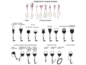 Морфология сперматозоидов 0%