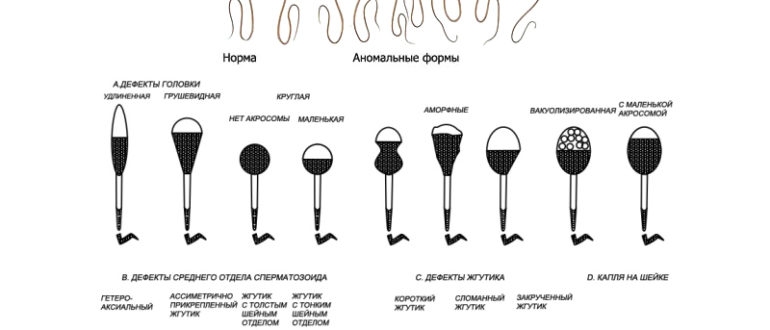 Морфология сперматозоидов 0%