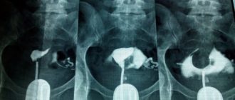 Можно ли делать проходимость труб с таким мазком?