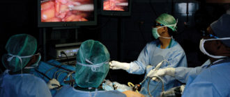 Можно ли обойтись без операции