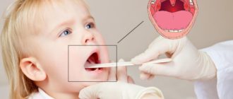 Высокая температура и аденоиды