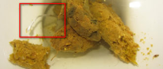 Черви в кале у ребёнка, что делать