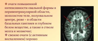 Чем опасны очаги повышенной интенсивности