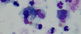 Дрожжи в мазке