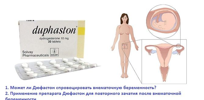 Внематочная беременность назначают дюфастон