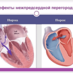 Выделение слизи под крайней плотью