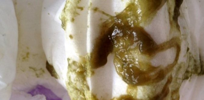 Черная слизь в 12 лет