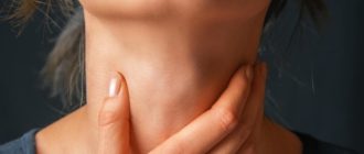 Диффузный зоб 2 степени АИТ