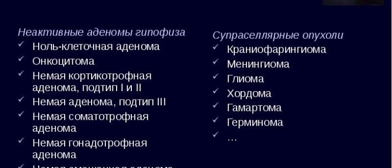 Микроаденома гипофиза гормонально неактивная