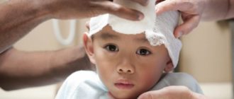 ЧМТ у ребенка