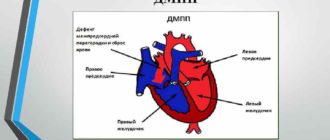 Дмпп 5 мм, нужна ли операция?