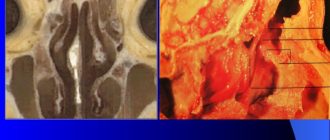 Вскрытие булл