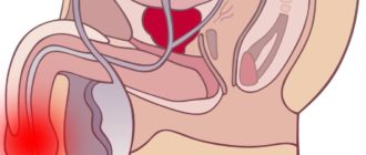 Чем я болею, постоянный дискомфорт в уретре