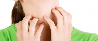 Чешется в горле