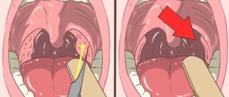 Чо то мешает во рту