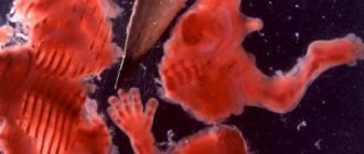 Месячные идут 3 месяца