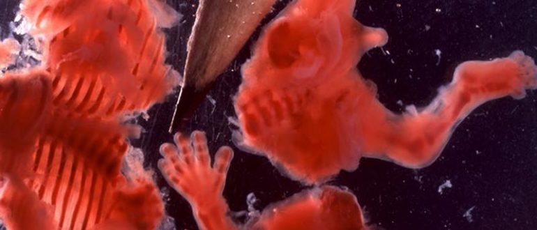 Месячные идут 3 месяца