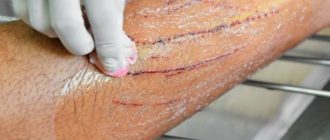 Кошка оцарапала возможно ли бешенство?