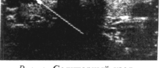 Узлы обних долей