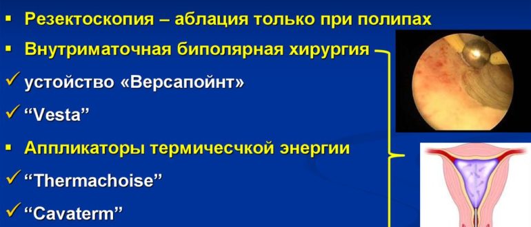 Чем вылечить гиперплазию эндометрия при многочисленных противопоказаниях