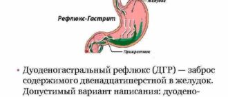 Дуоденогастральный рефлюкс, лимфоидный гастрит