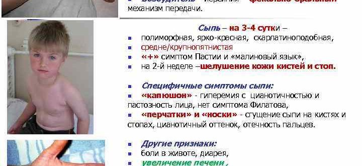 Архивы Инфекционист - Страница 5 из 15 - Совет медика Поиск картинок