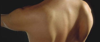 Выпирает лопатка при определенных движениях