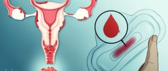 Месячные не идут ночью