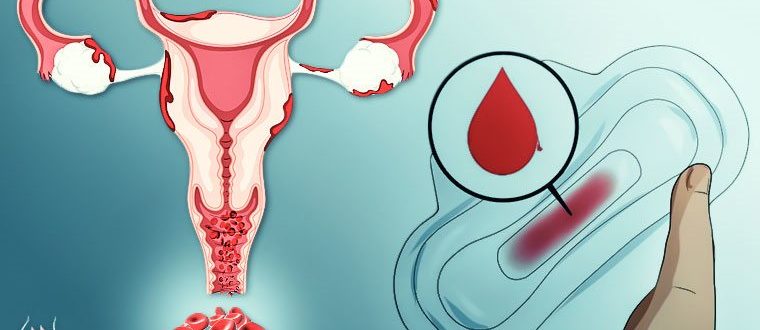 Месячные не идут ночью